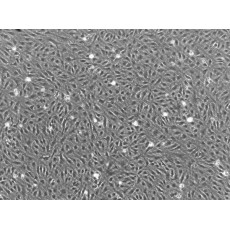 Human Dermal Microvascular Endothelial Cells (HDMVEC)